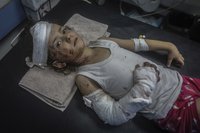 Injured Palestinian Child
